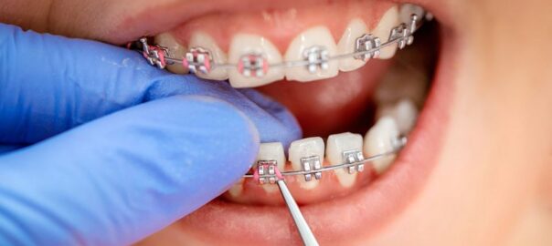 Orthodontist Near Me Carlsbad