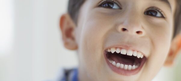 Teeth Whitening For Kids Carlsbad