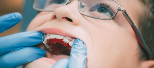 Orthodontist Carlsbad