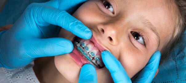 Orthodontist Near Me Carlsbad